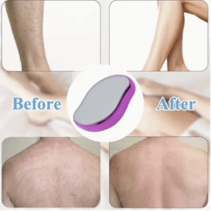 Crystal Hair Remover for Men & Women – Painless Exfoliating Hair Removal Tool | Reusable, Waterproof & Easy to Use | Available in Blue / Pink / Golden Beige / Purple